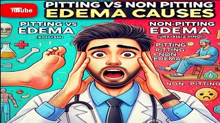 Pitting vs Non Pitting Edema Causes Surprising Facts You Didn’t Know [upl. by Lienet]