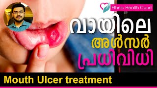 Mouth ulcer treatment  വായിലെ അൾസർ  പ്രധിവിധി  Ethnic Health Court [upl. by Shayna]