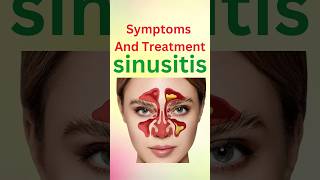 symptoms and treatment sinusitis shorts [upl. by Anyahs]