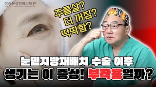 눈밑지방재배치 수술 후 생긴 이 증상 과연 부작용일까 [upl. by Fields]