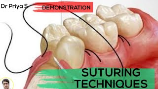 SUTURING TECHNIQUESDEMONSTRATION [upl. by Ilonka450]