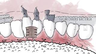 How Xylitol Works  Spry Dental Defense from Xlear [upl. by Immanuel]