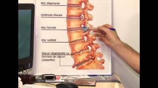 Dr VASILE DRUȚĂ  Medic Primar Ortopedie Traumatologie  COLOANA MEDICALĂ [upl. by Ammej174]