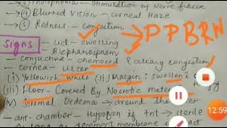 Bacterial corneal ulcer  hypopyon corneal ulcerclinical features and complications [upl. by Codi]