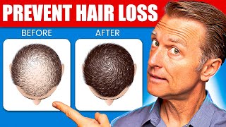 12 Proven Remedies to Prevent Hair Loss and Regrowth Regrow hair [upl. by Josy]