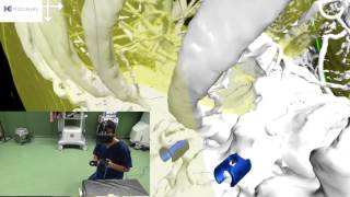 Virtual reality VR based simulators for spine surgery [upl. by Adlez]