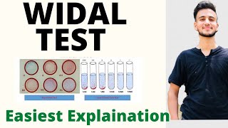 Widal Test in Hindi  Widal Test procedure  Widal Test [upl. by Sunda]