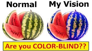 DIFFERENT TYPES of COLORBLINDNESS [upl. by Avrenim]