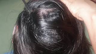 Scalp oiling using cotton buds  very relaxing  Hair parting  ASMR [upl. by Tonie]