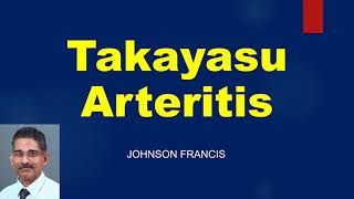 Takayasu Arteritis  Some Important Aspects [upl. by Yllom]