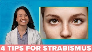 4 Great Ways to Treat Your Strabismus [upl. by Elocal959]