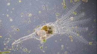 Stephanoceros fimbriatus  the most beautiful rotifer [upl. by Holcomb]