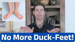 Walking Duck Footed 3 Exercises to Restore Straight Feet [upl. by Wayland583]