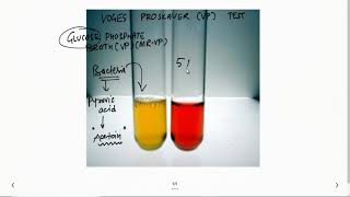 Voges Proskauer VP test 2 Minutes Microbiology Laboratory Methods Tutorials For NEETPG NEXT [upl. by Ailongam]