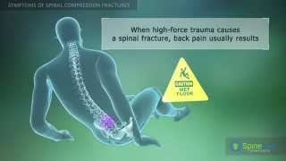 Spinal Compression Fracture Symptoms [upl. by Bevvy]