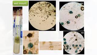 Mycology Lab Practical 6 Identification of unknown fungal isolates LKW [upl. by Attenreb756]