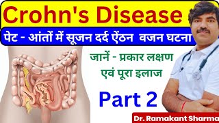 Crohns Disease A Comprehensive Guide to Diagnosis and Managementdrramakantsharma7 [upl. by Deehsar59]