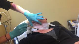 EndyMed Intensif Treatment with Lee Ann BatesKrueger [upl. by Ailido591]