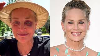 Sharon Stone reveals how she got a black eye after fan reaction to alarming injury photo news [upl. by Atcliffe918]