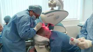 The UKs first hair transplant  by robot [upl. by Barb]