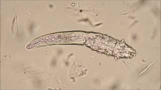 Demodex canis mites [upl. by Treve]