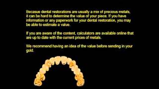 How To Sell Dental Gold [upl. by Ecaroh]