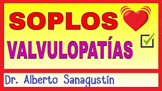 Cómo Memorizar los Soplos y las Valvulopatías Cardíacas [upl. by Aplihs]