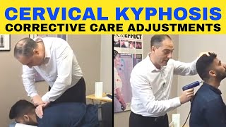 Cervical Kyphosis Corrective Chiropractic Care Adjustments  Dr Walter Salubro [upl. by Airuam]