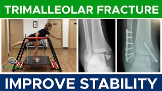 Trimalleolar Fracture  Improving Dynamic Ankle Stability  Part 2 [upl. by Wassyngton]