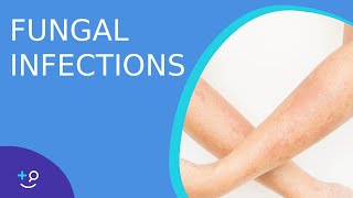 Fungal Infections  Causes Prevention and Cure [upl. by Ayahsal]