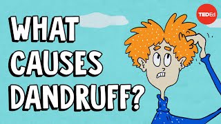 What causes dandruff and how do you get rid of it  Thomas L Dawson [upl. by Eivi]