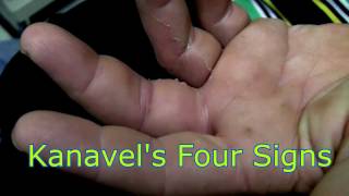 Kanavels Four Cardinal Signs [upl. by Acinonrev]