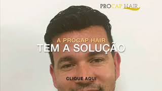 Procap Hair Antes e Depois  Satisfação Total [upl. by Ahsikrats]