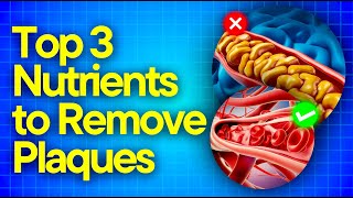 Best Nutrients For Clogged Arteries Arterial Plaques Removal [upl. by Acemat]