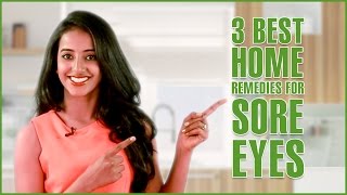 3 Simple Home Remedies For SORE EYES TREATMENT [upl. by Anitsuga145]