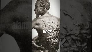 Black slave horrific scars whipped backhistoryshortsscarsblackescape [upl. by Chellman]