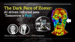 The Future of Herpes Zoster Care AIPowered Thermal Imaging for Accurate Diagnosis amp PHN Prediction [upl. by Dorey688]