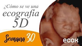 Vídeo ecografía semana 30 de embarazo  Ecox [upl. by Forlini336]