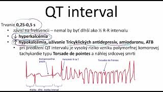 QT interval EKG [upl. by Emmott]