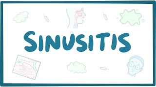 Sinusitis  causes symptoms diagnosis treatment pathology [upl. by Norym]