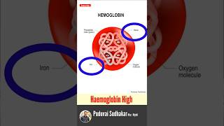 High Hemoglobin  🩸 hemoglobin hb அதிகபட்ச ஹீமோகுளோபின் என்ன  🩸❤️‼️ [upl. by Barret]