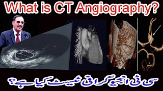 CT Angiography Test  MSCT Angiography Test kia hai  CT Angiogram [upl. by Arreip]