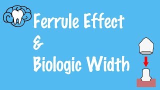 Ferrule Effect and Biologic Width [upl. by Perrins]