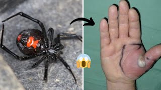 Top 6 MOST Venomous Spiders in the WORLD [upl. by Jackquelin]