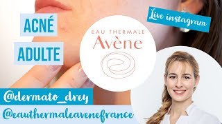 Live Dermato Drey et Avène  acné de ladulte boutons quotimperfectionsquot [upl. by Carine]