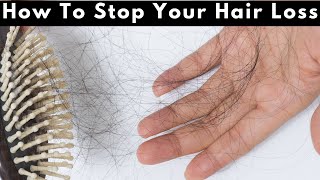 The Ultimate Guide to Stopping Hair Loss 288 [upl. by Atinas98]