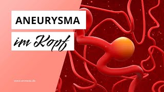 Aneurysma im Kopf Diese Symptome sind Warnzeichen [upl. by Rim411]