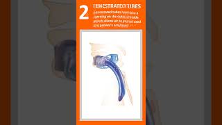 Different types of tracheostomy tubes l types of tracheostomy tube airwaymanagement medicaldevices [upl. by Lorene]