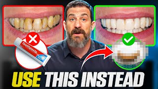 Neuroscientist quotToothpaste Is Damaging Your Teethquot How To Take Care of Your Teeth [upl. by Aileme]