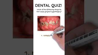 Dental quiz 7  Severely swollen gums  Drug induced [upl. by Griffis405]